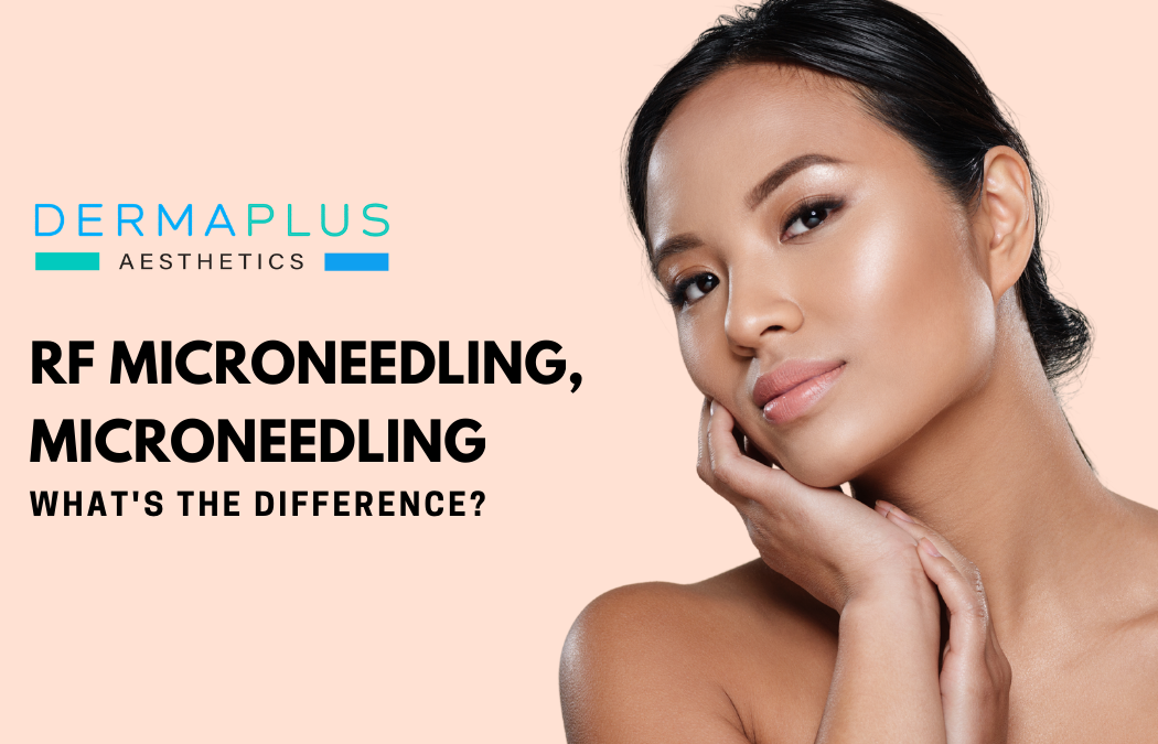What’s the difference between RF Microneedling and Microneedling?